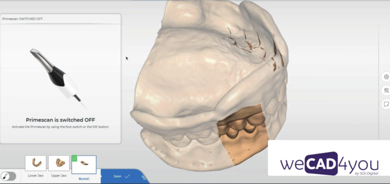 What are the technological gaps between the rapid evolution of the digital dental industry and the average user in intraoral digital impressions and digital acquisition?