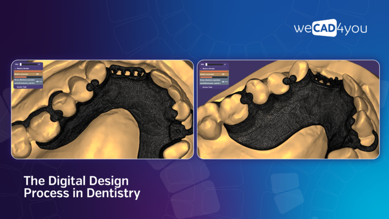Digital dental CAD software interface showing a detailed 3D mesh design of a removable partial denture framework on a maxilla model. Includes text 'The Digital Design Process in Dentistry' and the WeCAD4You logo on a blue and purple background.