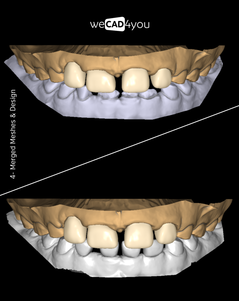 Digital 3D CAD mesh comparison of upper and lower arches before and after Chairside restoration design.
